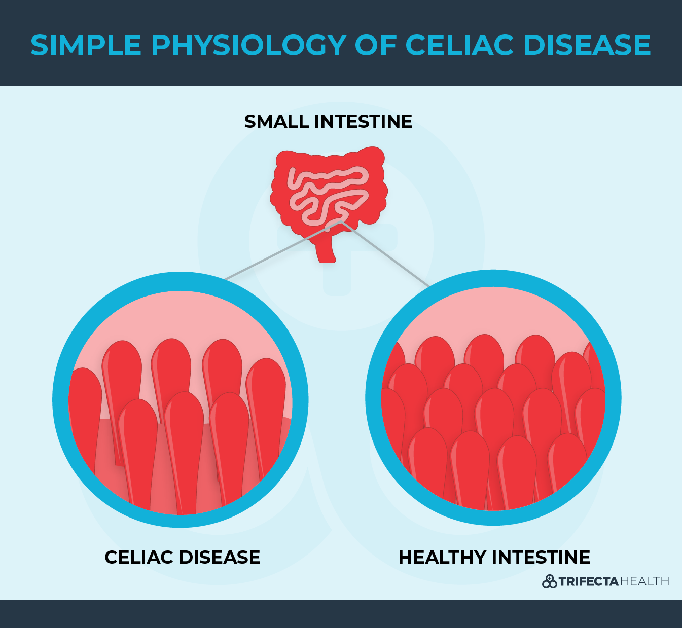 Celiac Disease 101 Symptoms, Causes & Treatment